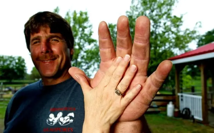 people with biggest hands in the world