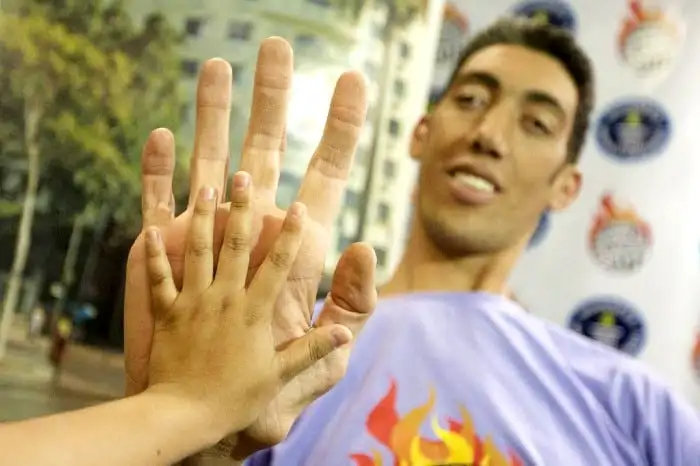 According to the Guinness World Records, the largest hand ever recorded belonged to Robert Wadlow, who had an arm span of 2.72 m (8 ft 11.1 in).